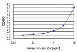 RIOK3, Human, Matched Antibody Pair (AP21), Abnova™