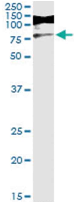 RIOK3, Human, IP-WB Antibody Pair (PW1), Abnova&trade;