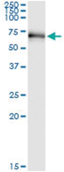 RIOK3, Human, IP-WB Antibody Pair (PW2), Abnova&trade;
