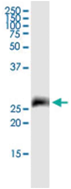 anti-TNFRSF18, Human, IP-WB Antibody Pair, Abnova 1 Set:Antibodies, Monoclonal/Polyclonal