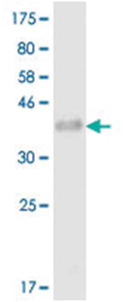 anti-TNFRSF11A, Clone: 1E12., Abnova 100 &mu;g | Buy Online | Abnova Corporation | Fisher Scientific