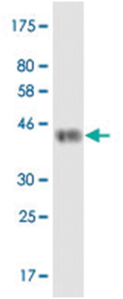 anti-TNFRSF11A, Clone: 2F4, Abnova 100 &mu;g | Buy Online | Abnova Corporation | Fisher Scientific