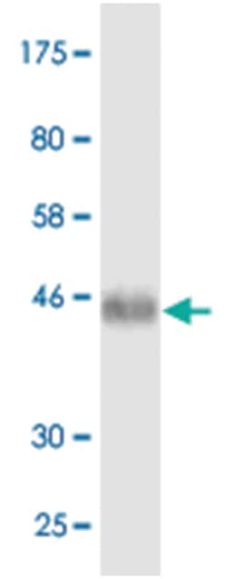 anti-TNFRSF11A, Clone: 2H6, Abnova 100 &mu;g | Buy Online | Abnova Corporation | Fisher Scientific
