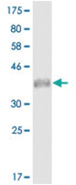 anti-TNFRSF11A, Clone: 6D12, Abnova 100 &mu;g | Buy Online | Abnova Corporation | Fisher Scientific