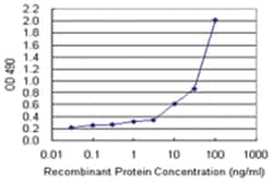 anti-TNFRSF10B Matched Antibody Pair, Abnova™