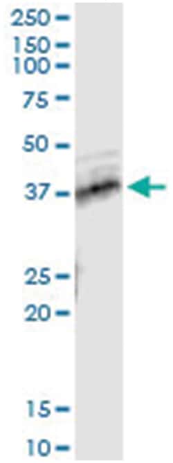TNFRSF10B, Human, IP-WB Antibody Pair (PW2), Abnova 1 Set:Antibodies, Monoclonal/Polyclonal