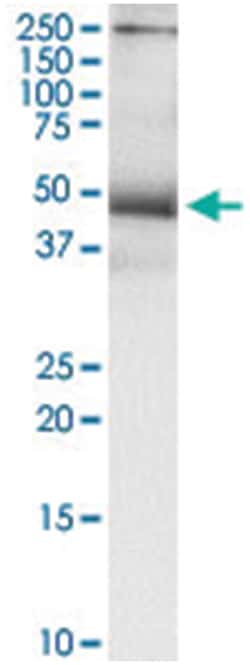 TNFRSF10B, Human, IP-WB Antibody Pair (PW3), Abnova 1 Set:Antibodies, Monoclonal/Polyclonal
