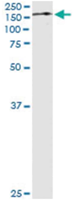 anti-TRIM24, Human, IP-WB Antibody Pair, Abnova 1 Set:Antibodies, Monoclonal/Polyclonal