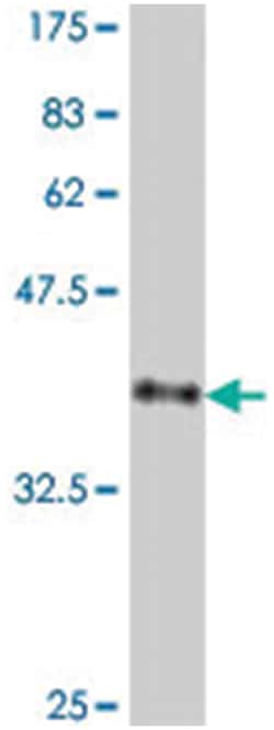 IL1RL2, Mouse, Polyclonal Antibody, Abnova 50&mu;L; Unlabeled:Antibodies,