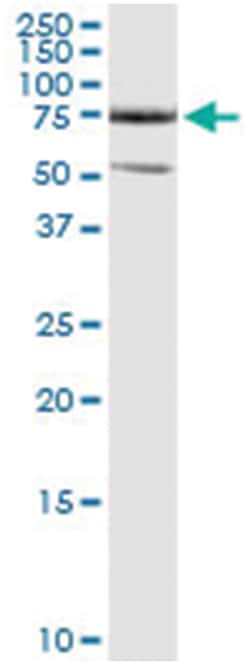 CFLAR, Human, IP-WB Antibody Pair (PW1), Abnova&trade;