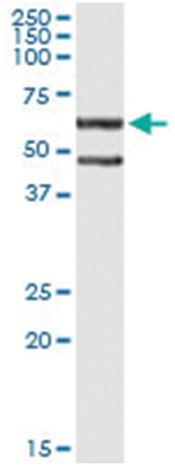 CFLAR, Human, IP-WB Antibody Pair (PW2), Abnova&trade;