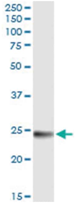 WISP2, Human, IP-WB Antibody Pair (PW1), Abnova&trade;