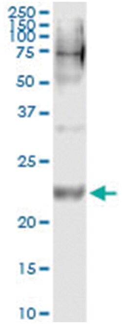 WISP2, Human, IP-WB Antibody Pair (PW2), Abnova 1 Set:Antibodies, Monoclonal/Polyclonal