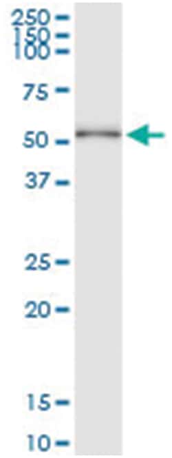 HDAC3, Human, IP-WB Antibody Pair (PW1), Abnova 1 Set:Antibodies, Monoclonal/Polyclonal