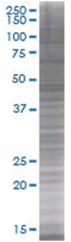 HDAC3 293T Cell Overexpression Lysate (Denatured), Abnova