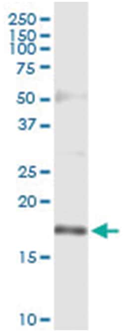 anti-TSC22D1, Human, IP-WB Antibody Pair, Abnova&trade;