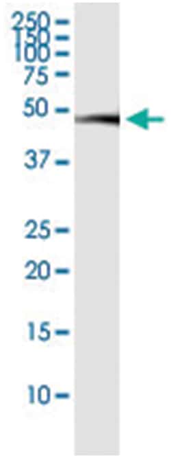 anti-NR1I2, Human, IP-WB Antibody Pair, Abnova 1 Set:Antibodies, Monoclonal/Polyclonal