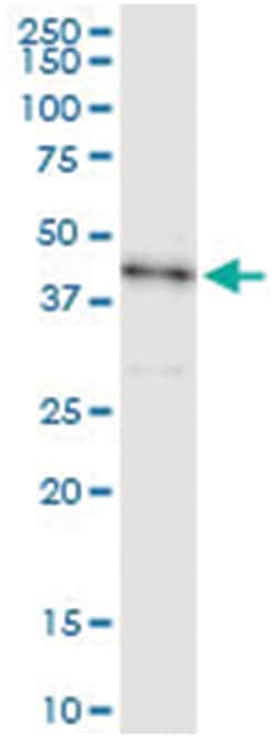 STK19, Human, IP-WB Antibody Pair (PW1), Abnova 1 Set:Antibodies, Monoclonal/Polyclonal