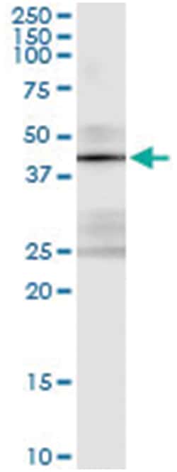 STK19, Human, IP-WB Antibody Pair (PW2), Abnova&trade;
