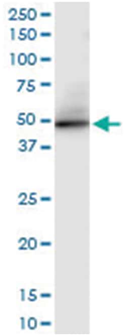 PER3, Human, IP-WB Antibody Pair (PW1), Abnova&trade;