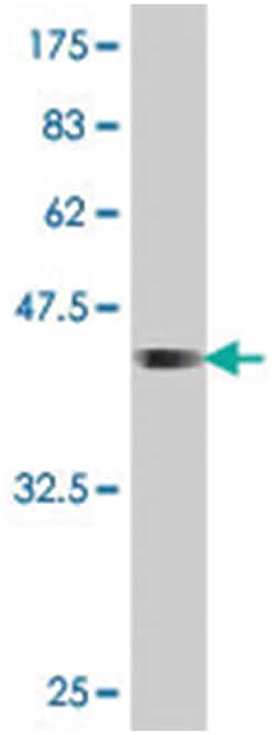 period homolog 2 (Drosophila), Mouse, Polyclonal Antibody, Abnova 50 &mu;L | Buy Online | Abnova | Fisher Scientific