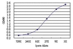 Abnova anti-SYNJ2 Matched Antibody Pair, Abnova™