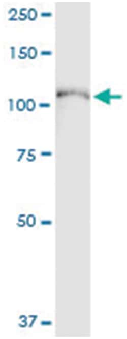 anti-SYNJ2, Human, IP-WB Antibody Pair, Abnova™