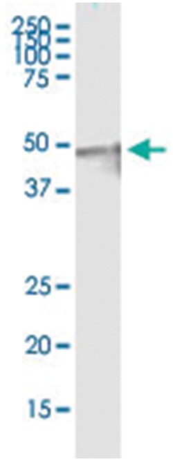 anti-CDC123, Human, IP-WB Antibody Pair, Abnova 1 Set:Antibodies, Monoclonal/Polyclonal