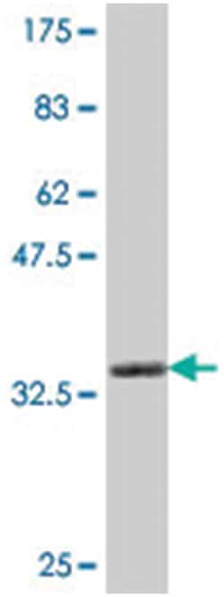 Rho guanine nucleotide exchange factor (GEF) 7, Mouse, Polyclonal Antibody, Abnova&trade;