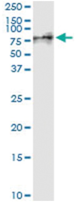 VNN1, Human, IP-WB Antibody Pair (PW1), Abnova 1 Set:Antibodies, Monoclonal/Polyclonal