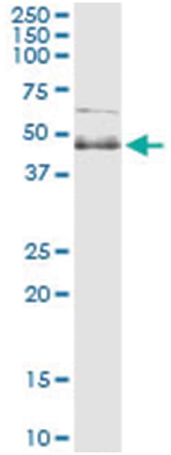 SPHK1, Human, IP-WB Antibody Pair (PW2), Abnova&trade;