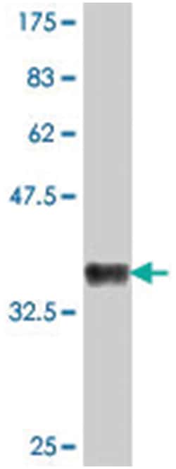 FUBP1, Mouse, Polyclonal Antibody, Abnova 50&mu;L; Unlabeled:Antibodies,