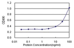 anti-CPNE1 Matched Antibody Pair, Abnova 1 set, Unlabeled:Antibodies, Monoclonal/Polyclonal