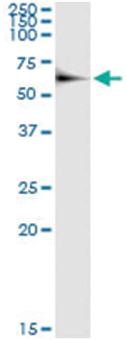 anti-CPNE1, Human, IP-WB Antibody Pair, Abnova&trade;