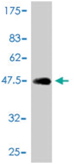 AP1S2, Mouse, Polyclonal Antibody, Abnova 50&mu;L; Unlabeled:Antibodies,
