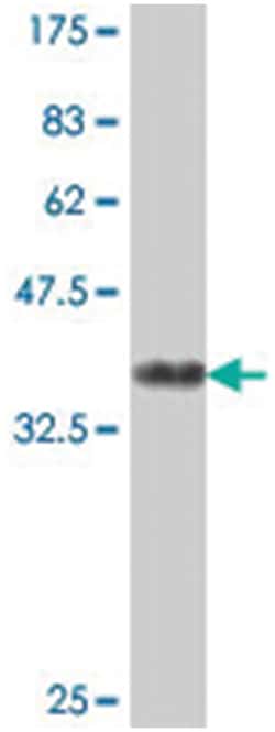 AP1G2, Mouse, Polyclonal Antibody, Abnova 50&mu;L; Unlabeled:Antibodies,
