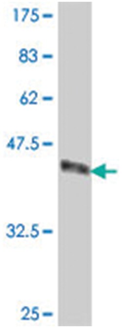 HERC3, Mouse, Polyclonal Antibody, Abnova 50&mu;L; Unlabeled:Antibodies,