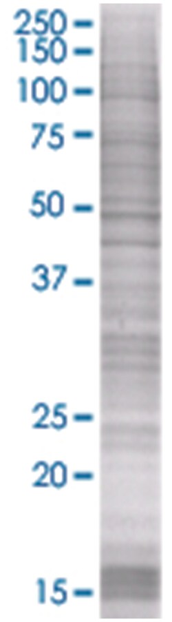 SNURF 293T Cell Overexpression Lysate (Denatured), Abnova 100&mu;L | Buy Online | Abnova | Fisher Scientific