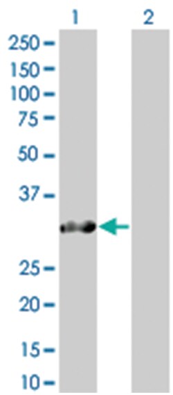 SNURF 293T Cell Overexpression Lysate (Denatured), Abnova 100&mu;L | Buy Online | Abnova | Fisher Scientific