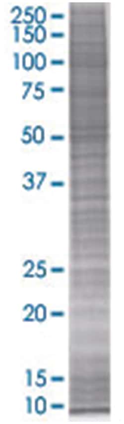 SCAP2 293T Cell Overexpression Lysate (Denatured), Abnova
