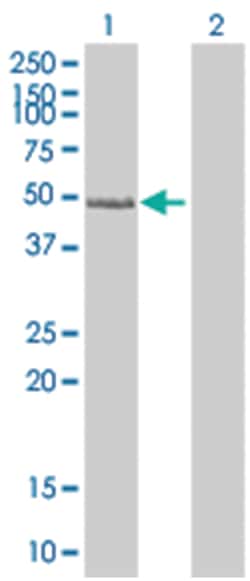 SCAP2 293T Cell Overexpression Lysate (Denatured), Abnova