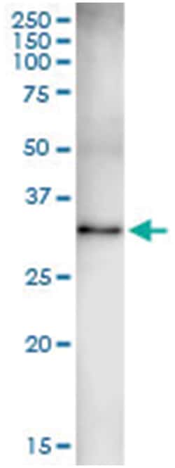 anti-KYNU, Human, IP-WB Antibody Pair, Abnova™