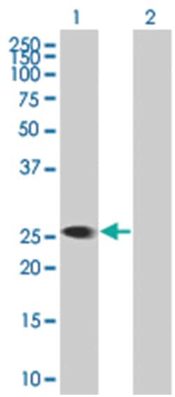 KYNU 293T Cell Overexpression Lysate (Denatured), Abnova 100 &mu;l | Buy Online | Abnova | Fisher Scientific