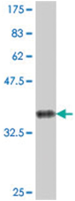 SEMA5A, Mouse, Polyclonal Antibody, Abnova 50 &mu;L | Buy Online | Abnova Corporation | Fisher Scientific