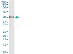SH2D2A, Human, IP-WB Antibody Pair (PW1), Abnova&trade;