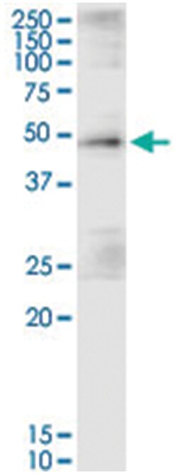SH2D2A, Human, IP-WB Antibody Pair (PW2), Abnova™