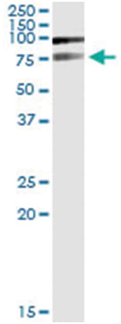 anti-PIAS2, Human, IP-WB Antibody Pair, Abnova 1 Set:Antibodies, Monoclonal/Polyclonal
