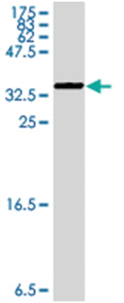 MAP3K6, Mouse, Polyclonal Antibody, Abnova 50&mu;L; Unlabeled:Antibodies,