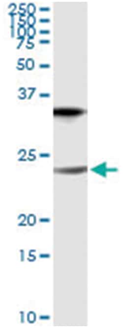 CLDN1, Human, IP-WB Antibody Pair (PW2), Abnova&trade;