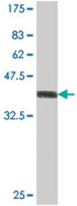 EIF1AY, Mouse, Polyclonal Antibody, Abnova 50 &mu;L | Buy Online | Abnova | Fisher Scientific